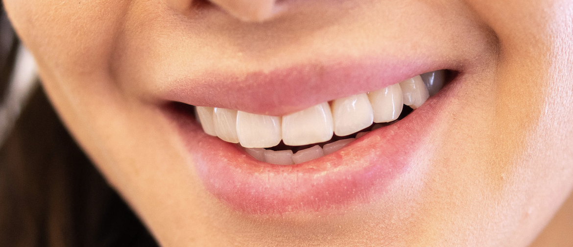 whitening answered