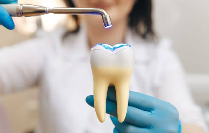 When a cavity leaves a hole in your tooth due to dental decay, tooth fillings are used to repair or restore the tooth.