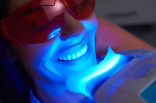Professional teeth whitening is done by a dentist or other qualified dental professional inside a dental clinic.