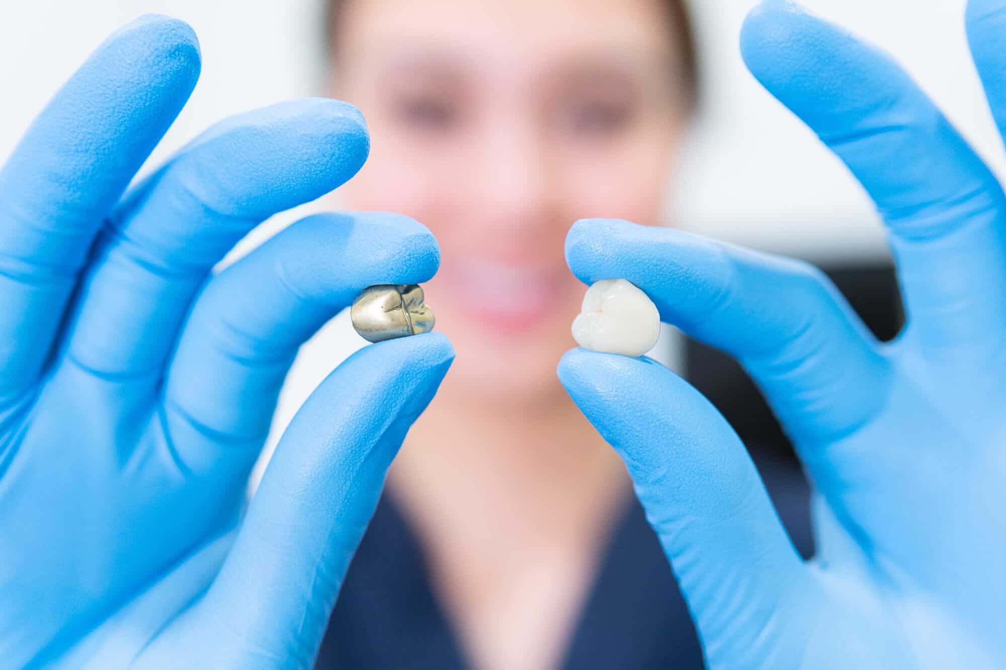 Different types of dental crown options at Chelmsford Dental Mount Lawley