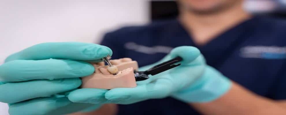 Dental Implants in Perth Process, Recovery and What to Expect
