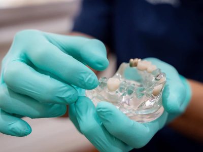 Dental crown restoration at Chelmsford Dental Mount Lawley