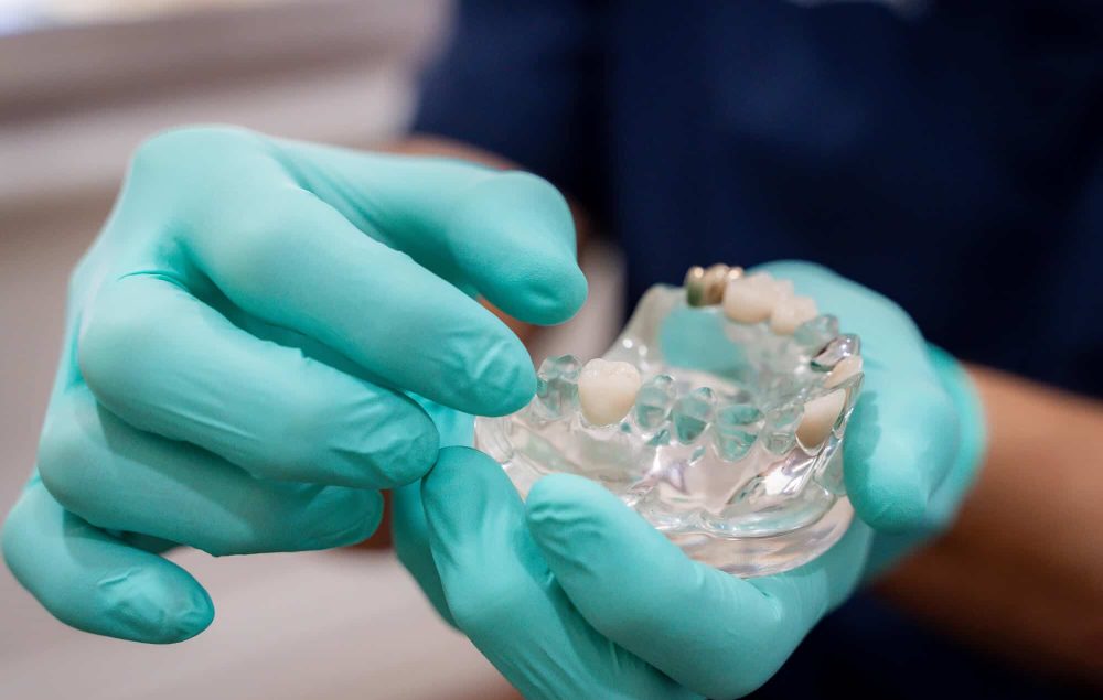 Dental crown restoration at Chelmsford Dental Mount Lawley