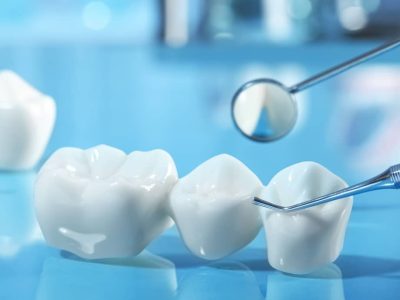 When considering all your tooth replacement options, dental bridges are an excellent aesthetic solution for missing teeth.
