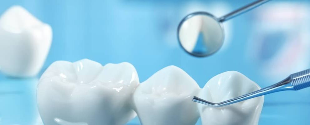 When considering all your tooth replacement options, dental bridges are an excellent aesthetic solution for missing teeth.