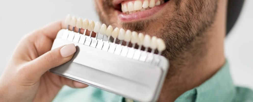 The choice between porcelain and composite veneers depends on factors such as budget, desired aesthetics, durability, and the recommendation of your dentist.