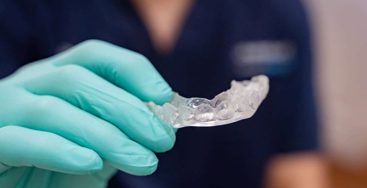 Clear bite splint to help reduce teeth grinding
