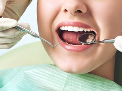 During a checkup, the dentist will check the general health of your teeth, gums and mouth. Instruments will be used to allow all parts of your mouth and teeth to be properly inspected.