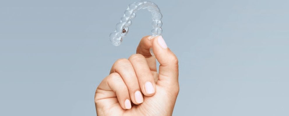 Invisalign