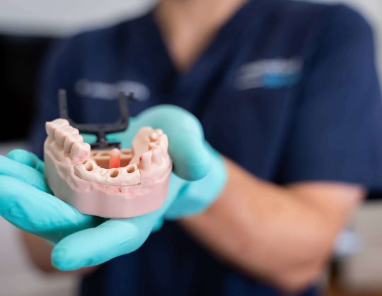 missing teeth in clay mouth