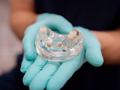 dentist holding mouth model with missing teeth
