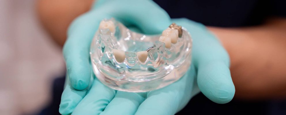 dentist holding mouth model with missing teeth
