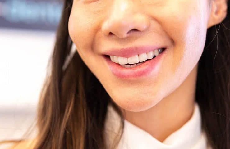 lady smiling after having teeth whitening service