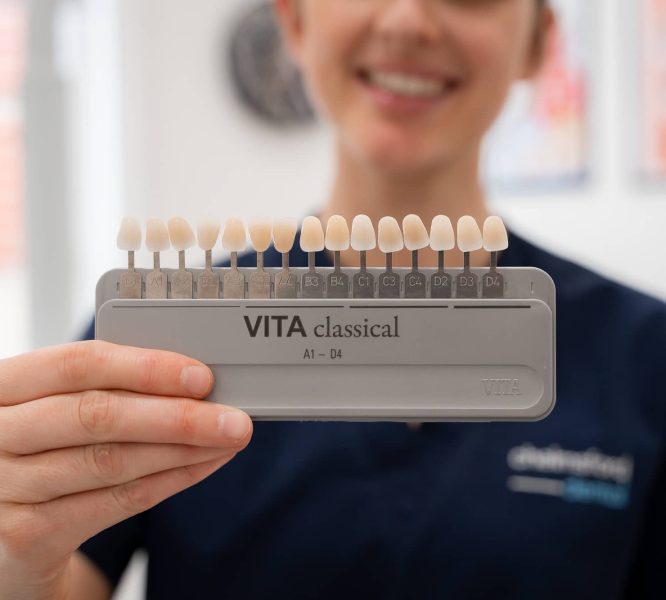 Expert Dentist holding colour match pallet to match veneers to natural teeth