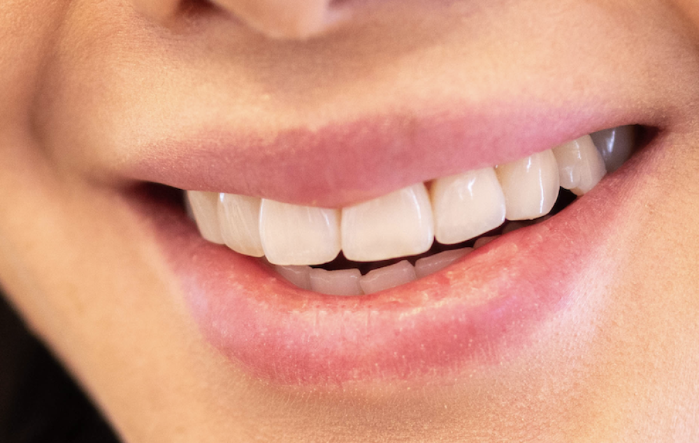 White and straight teeth from a Chelmsford Dental patient.