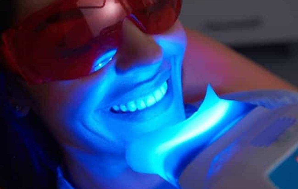 lady using fluoride teeth whitening machine